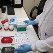 La CSJ implementa nuevos procedimientos a ser aplicados para las pruebas de Histocompatibilidad (HLA) e Inmunogenética (ADN).